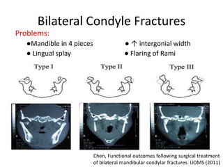 Bilateral Condyle Fractures
Problems:
●Mandible in 4 pieces ● ↑ intergonial width
● Lingual splay ● Flaring of Rami
Chen, Functional outcomes following surgical treatment
of bilateral mandibular condylar fractures. IJOMS (2011)
 