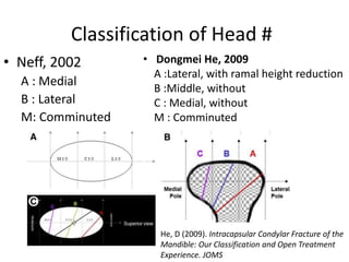 Classification of Head #
• Neff, 2002
A : Medial
B : Lateral
M: Comminuted
• Dongmei He, 2009
A :Lateral, with ramal height reduction
B :Middle, without
C : Medial, without
M : Comminuted
He, D (2009). Intracapsular Condylar Fracture of the
Mandible: Our Classification and Open Treatment
Experience. JOMS
 