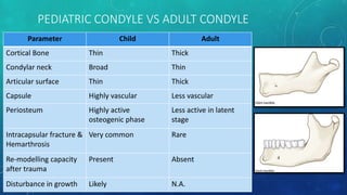 Condylar fractures | PPTX