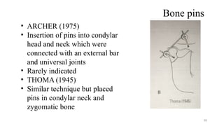 CONDYLAR FRACTURES AND ITS MANAGEMENT.pptx