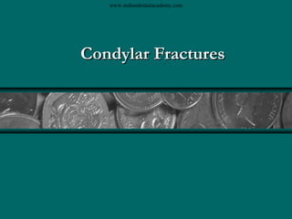 www.indiandentalacademy.com

Condylar Fractures

 