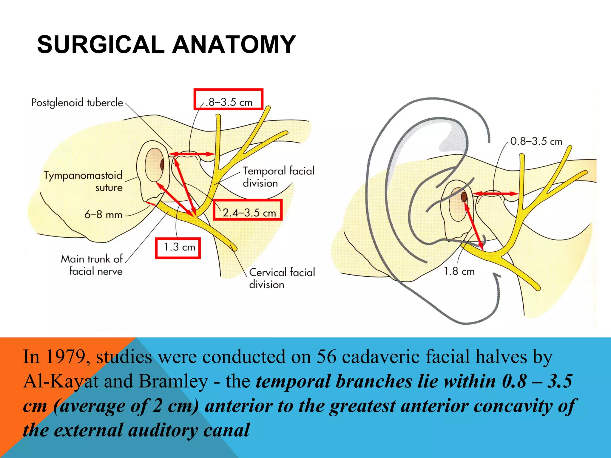 Condylar fractures | PPT