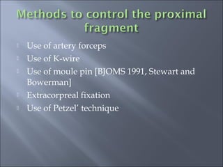  Use of artery forceps
 Use of K-wire
 Use of moule pin [BJOMS 1991, Stewart and
Bowerman]
 Extracorpreal fixation
 Use of Petzel’ technique
 