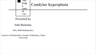 Condylar hyperplasia
Presented by
Safa Basiouny
MSc, PhD Orthodontics
Lecturer of Orthoontics, Faculty of Dentistry, Tanta
University
 
