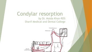 Condylar resorption
by Dr. Maida Khan-RDS
Sharif Medical and Dental College
 