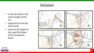 Condylar fractures | PPTX