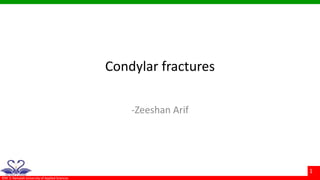 ©M. S. Ramaiah University of Applied Sciences
1
Condylar fractures
-Zeeshan Arif
 