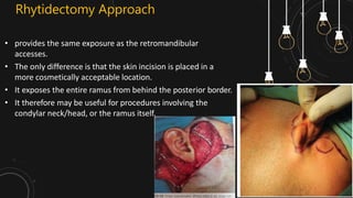 Management of Mandibular Condyle fracture | PPTX