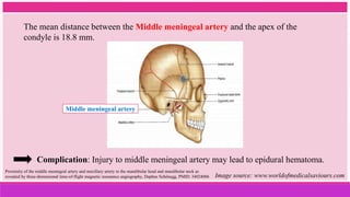 The mean distance between the Middle meningeal artery and the apex of the
condyle is 18.8 mm.
Middle meningeal artery
Proximity of the middle meningeal artery and maxillary artery to the mandibular head and mandibular neck as
revealed by three-dimensional time-of-flight magnetic resonance angiography, Daphne Schönegg, PMID: 34024006 Image source: www.worldofmedicalsaviours.com
Complication: Injury to middle meningeal artery may lead to epidural hematoma.
 