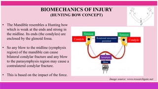 BIOMECHANICS OF INJURY
(HUNTING BOW CONCEPT)
• The Mandible resembles a Hunting bow
which is weak at the ends and strong in
the midline. Its ends (the condyles) are
enclosed by the glenoid fossa.
• So any blow to the midline (symphysis
region) of the mandible can cause
bilateral condylar fracture and any blow
to the parasymphysis region may cause a
contralateral condylar fracture.
• This is based on the impact of the force.
Condyle
Tension
Rotational movement
permitted
Tension
Condyle
Symphysis
Blow
Image source: www.researchgate.net
T
T T
C C
C
 