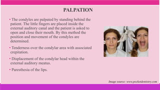 PALPATION
• The condyles are palpated by standing behind the
patient. The little fingers are placed inside the
external auditory canal and the patient is asked to
open and close their mouth. By this method the
position and movement of the condyles are
determined.
• Tenderness over the condylar area with associated
crepitation.
• Displacement of the condylar head within the
external auditory meatus.
• Paresthesia of the lips.
Image source: www.pocketdentistry.com
 