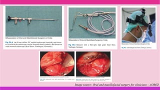 Image source: Oral and maxillofacial surgery for clinicians – AOMSI
 