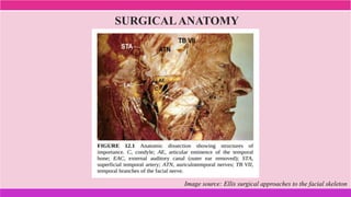Image source: Ellis surgical approaches to the facial skeleton
SURGICALANATOMY
 