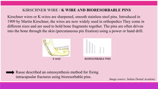 Kirschner wires or K-wires are sharpened, smooth stainless steel pins. Introduced in
1909 by Martin Kirschner, the wires are now widely used in orthopedics They come in
different sizes and are used to hold bone fragments together. The pins are often driven
into the bone through the skin (percutaneous pin fixation) using a power or hand drill.
KIRSCHNER WIRE / K WIRE AND BIORESORBABLE PINS
Image source: Indian Dental Academy
Rasse described an osteosynthesis method for fixing
intracapsular fractures using bioresorbable pins.
K WIRE BIORESORBABLE PINS
 