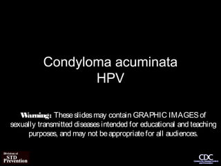 Condyloma acuminata
                 HPV

   W arning: These slides may contain GRAPHIC IMAGES of
sexually transmitted diseases intended for educational and teaching
     purposes, and may not be appropriate for all audiences.
 