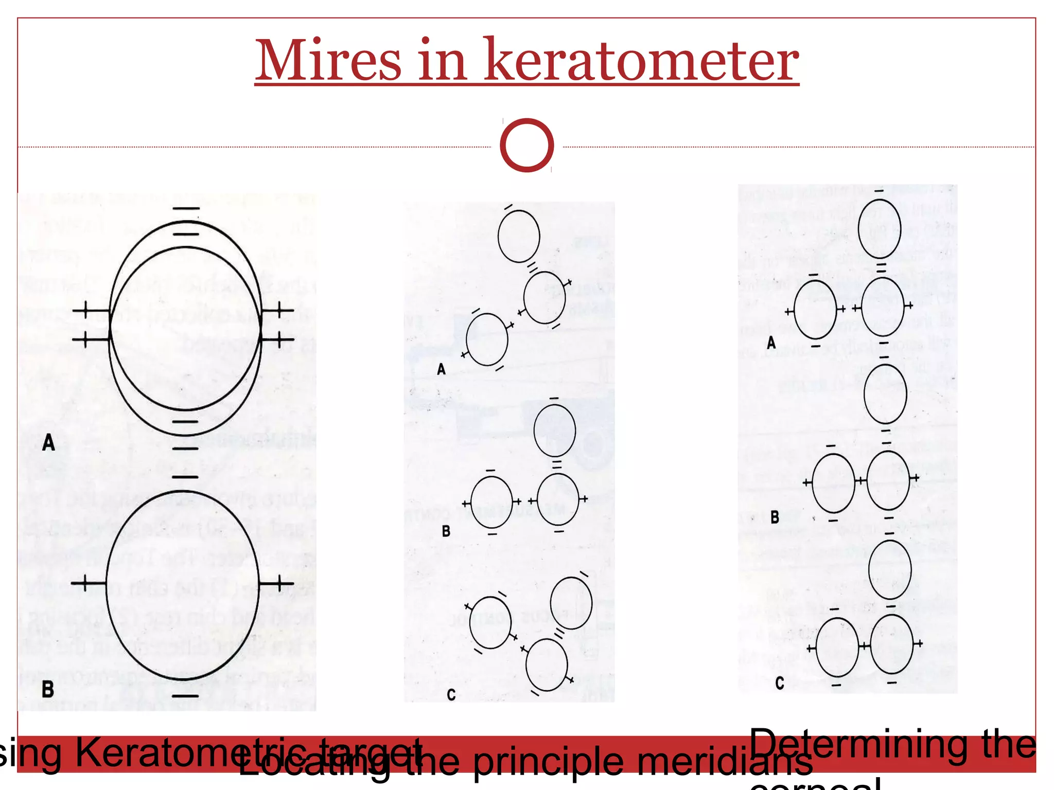 Mires in keratometer
sing Keratometric targetLocating the principle meridiansDetermining the
 