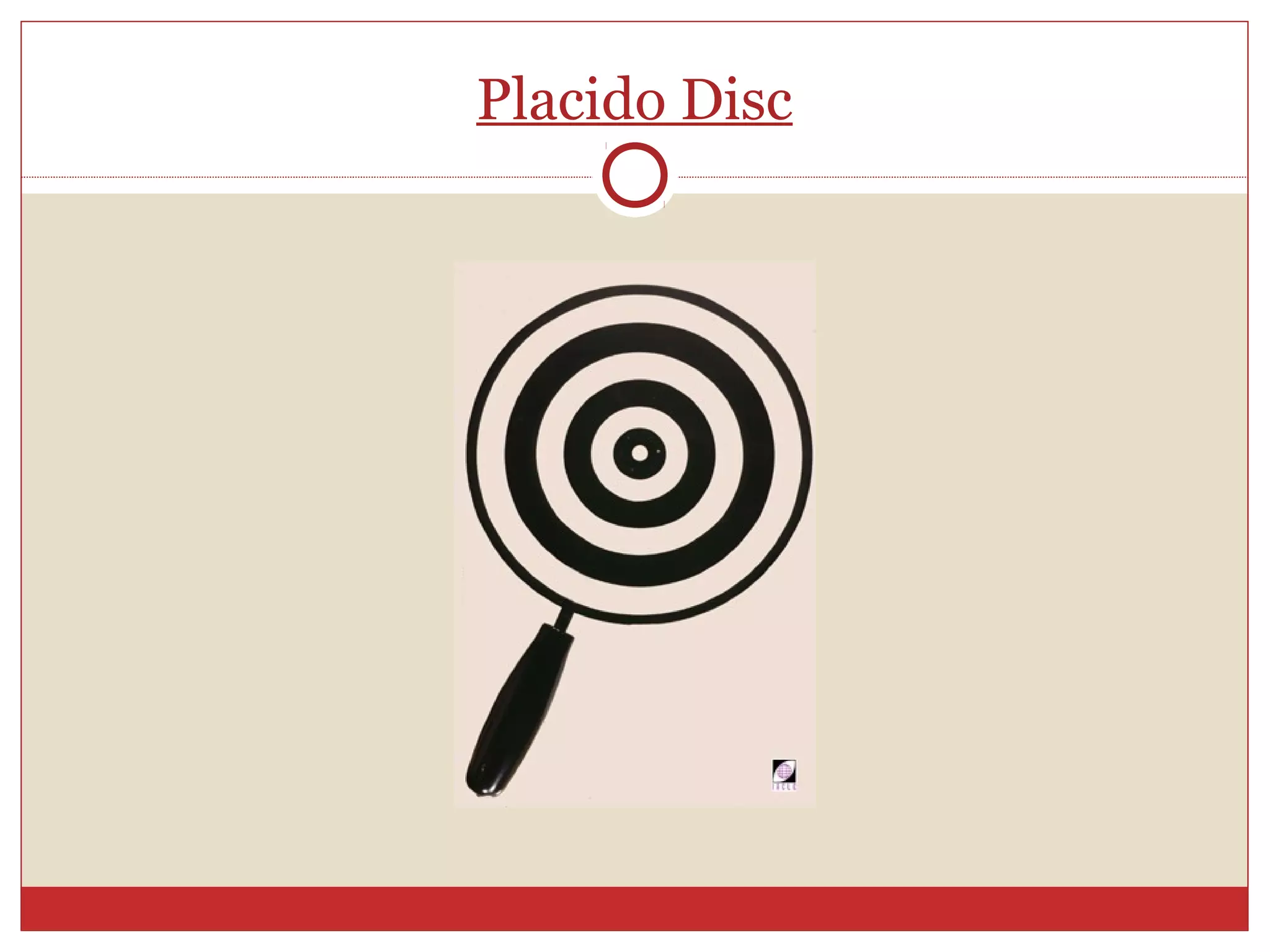 Placido Disc
 