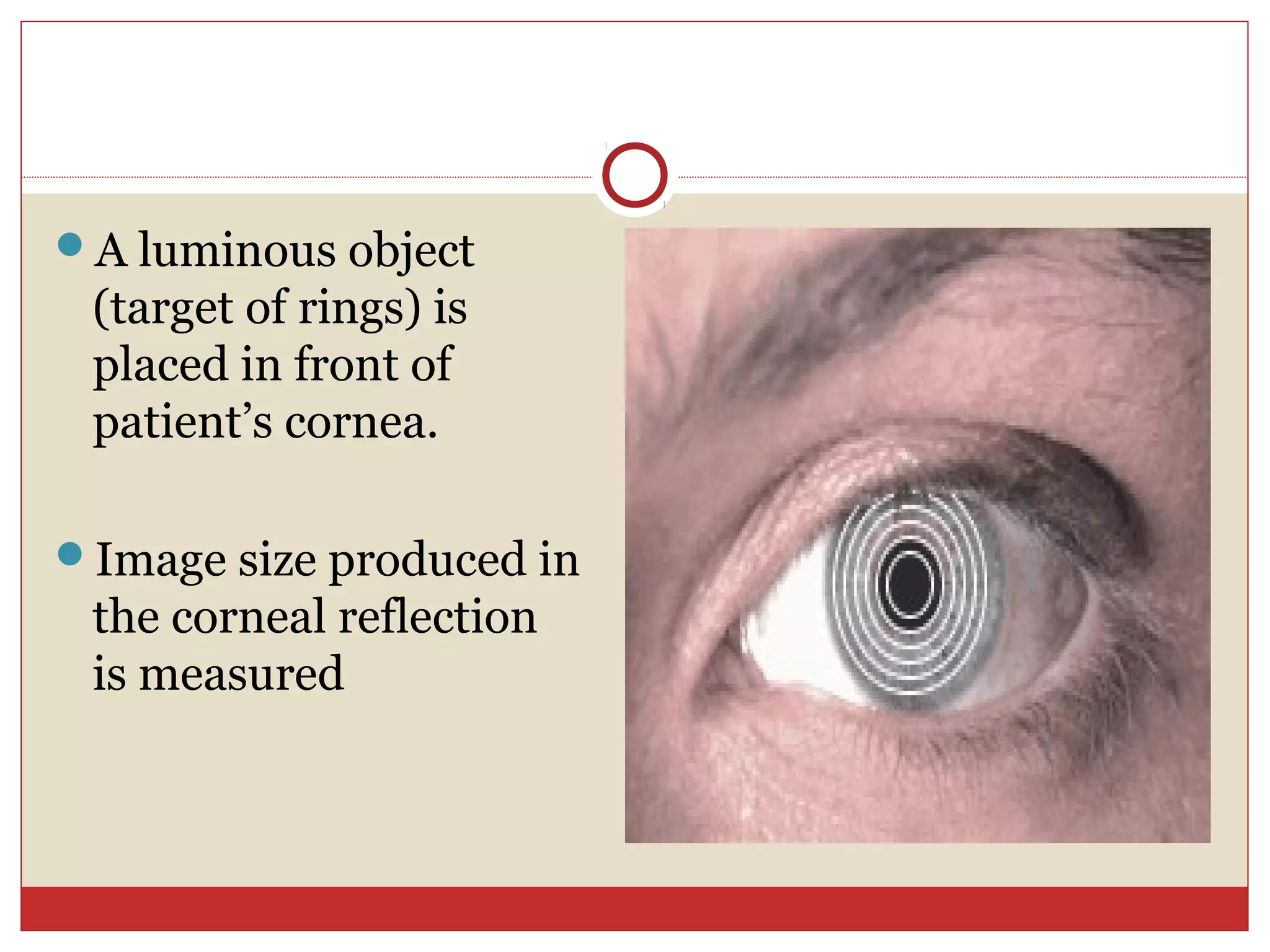 A luminous object
(target of rings) is
placed in front of
patient’s cornea.
Image size produced in
the corneal reflection
is measured
 