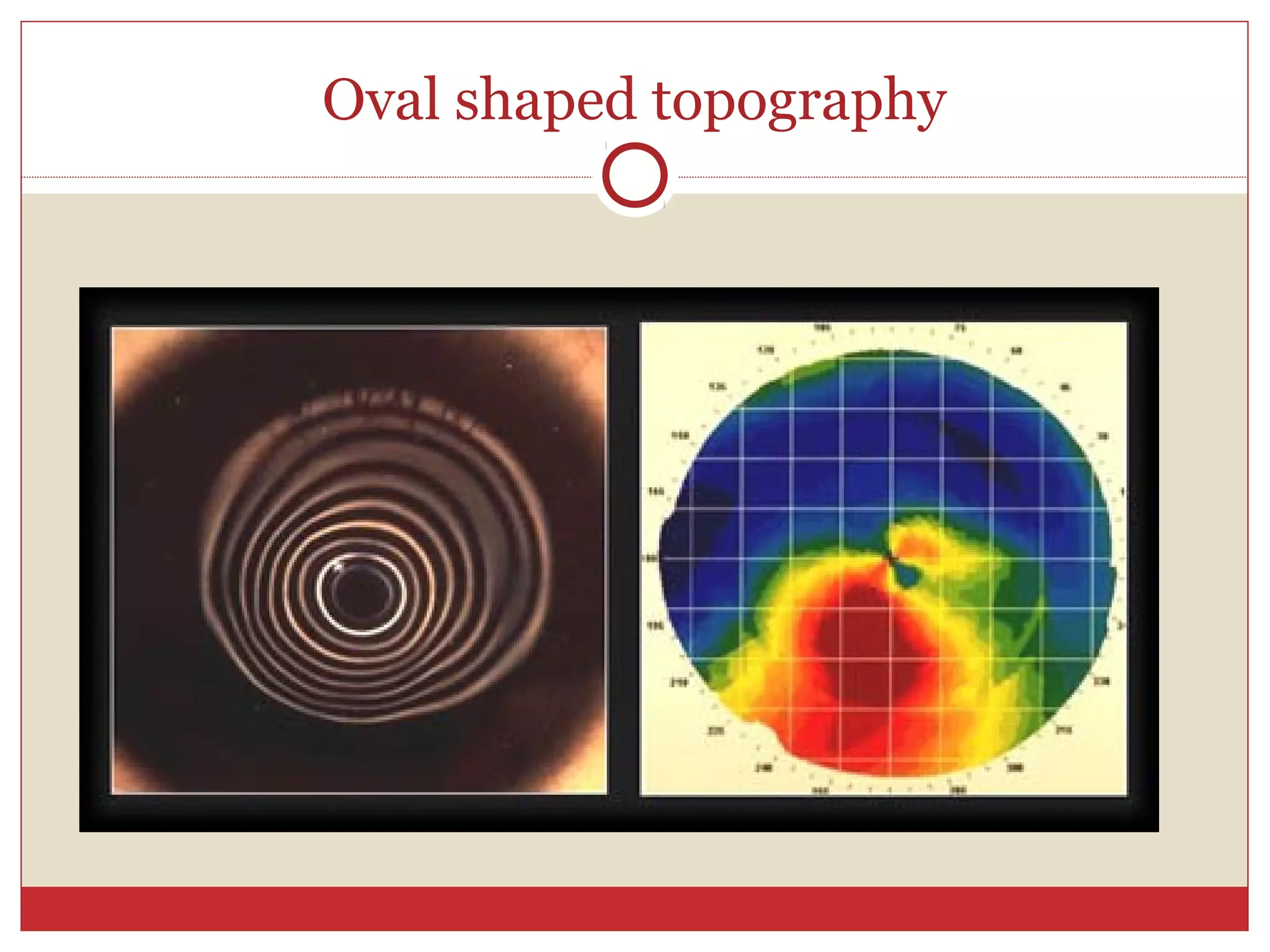 Oval shaped topography
 