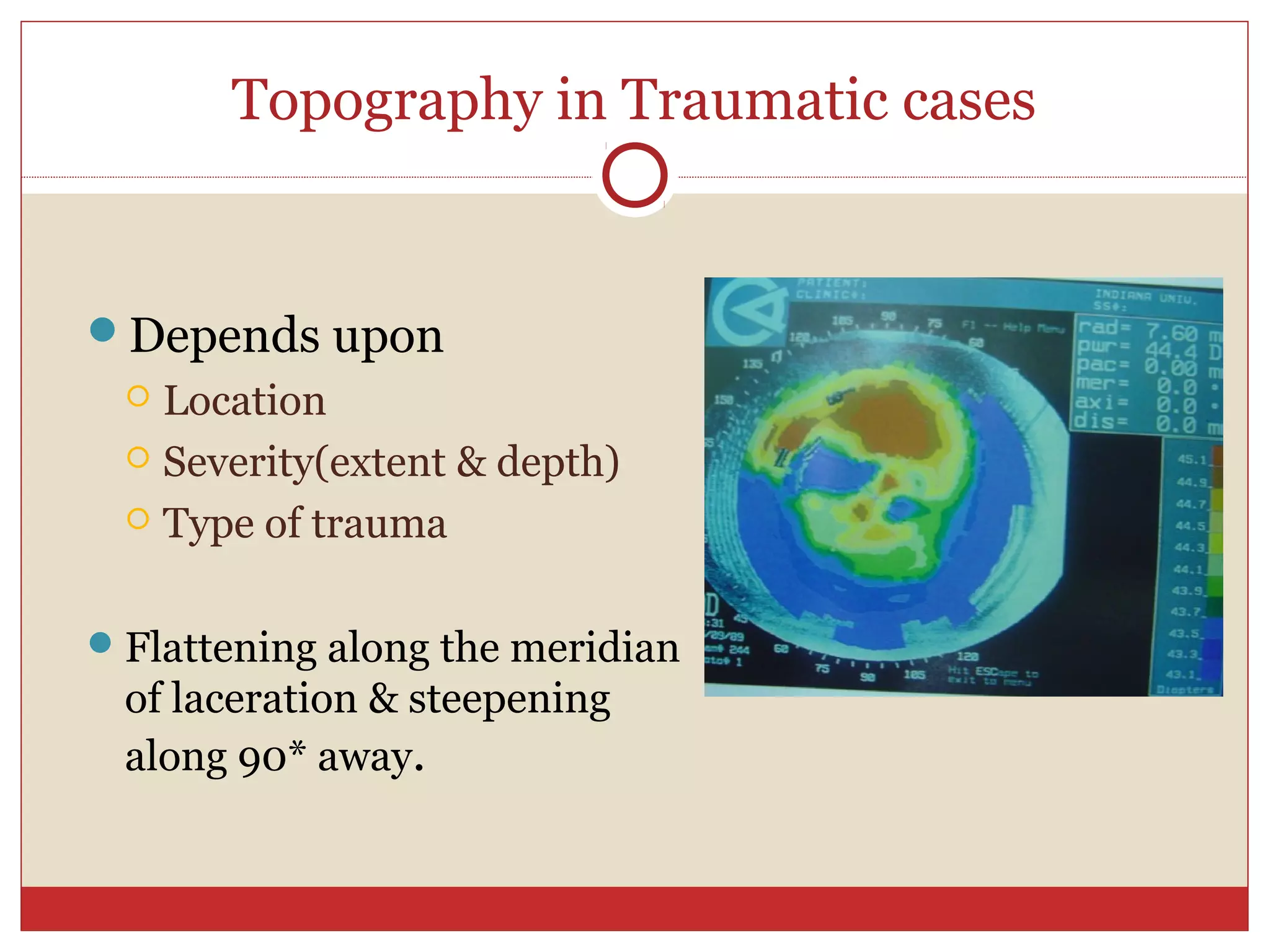 Topography in Traumatic cases
Depends upon
 Location
 Severity(extent & depth)
 Type of trauma
Flattening along the meridian
of laceration & steepening
along 90* away.
 