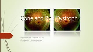 Cone and Rod Dystrophy
Presenter : Dr Samarth Mishra
Moderator: Dr Parveen Sen
 