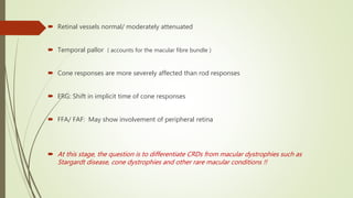  Retinal vessels normal/ moderately attenuated
 Temporal pallor ( accounts for the macular fibre bundle )
 Cone responses are more severely affected than rod responses
 ERG: Shift in implicit time of cone responses
 FFA/ FAF: May show involvement of peripheral retina
 At this stage, the question is to differentiate CRDs from macular dystrophies such as
Stargardt disease, cone dystrophies and other rare macular conditions !!
 