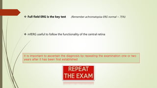 It is important to ascertain the diagnosis by repeating the examination one or two
years after it has been first established
 Full field ERG is the key test (Remember achromatopisa ERG normal ~ 75%)
 mfERG useful to follow the functionality of the central retina
 