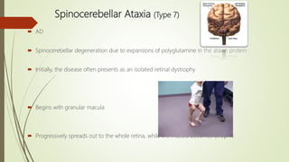 Spinocerebellar Ataxia (Type 7)
 AD
 Spinocerebellar degeneration due to expansions of polyglutamine in the ataxin protein
 Initially, the disease often presents as an isolated retinal dystrophy
 Begins with granular macula
 Progressively spreads out to the whole retina, while the macula becomes atrophic
 