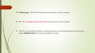  Funduscopy: Mild RPE disturbance to extensive macular atrophy
 FAF: An increased signal at the fovea may be seen in early disease
 AOSLO: Has identified cellular variability between two related patients harbouring a
single 428delTinsAC AC insertion/ deletion variant
 