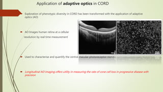 Application of adaptive optics in CORD
 Exploration of phenotypic diversity in CORD has been transformed with the application of adaptive
optics (AO)
 AO Images human retina at a cellular
resolution by real time measurement
 Used to characterise and quantify the central macular photoreceptor mosaic
 Longitudinal AO imaging offers utility in measuring the rate of cone cell loss in progressive disease with
precision
 