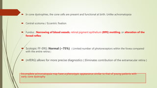  In cone dystrophies, the cone cells are present and functional at birth. Unlike achromatopsia
 Central scotoma / Eccentric fixation
 Fundus : Narrowing of blood vessels, retinal pigment epithelium (RPE) mottling, or alteration of the
foveal reflex
 Scotopic FF-ERG: Normal (~75%) ( Limited number of photoreceptors within the fovea compared
with the entire retina )
 (mfERG) allows for more precise diagnostics ( Eliminates contribution of the extramacular retina )
Incomplete achromatopsia may have a phenotypic appearance similar to that of young patients with
early cone dystrophy
 