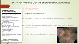 D/D of non syndromic CRDs with other pigmentary retinopathies
 Retinitis pigmentosa
A) Typical RP (rod cone dystrophy, RCD)
 In typical RCD, the diagnosis is easy because the first symptom is night blindness
 Remains isolated for several years with normal V/A before vision loss in day- light
becomes prominent
 Fundus: Pigment deposits located in the periphery
 