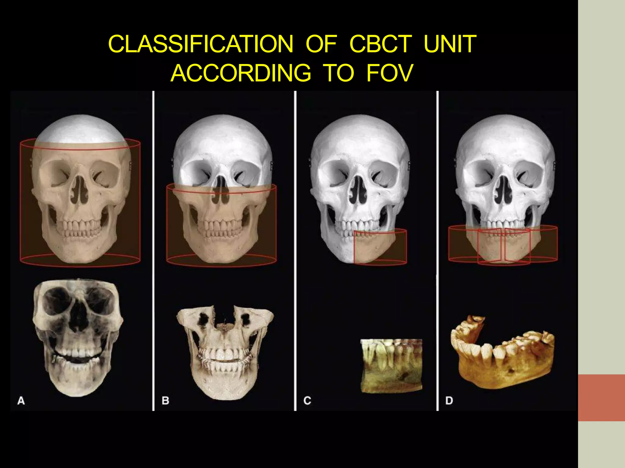 CLASSIFICATION OF CBCT UNIT
ACCORDING TO FOV
 