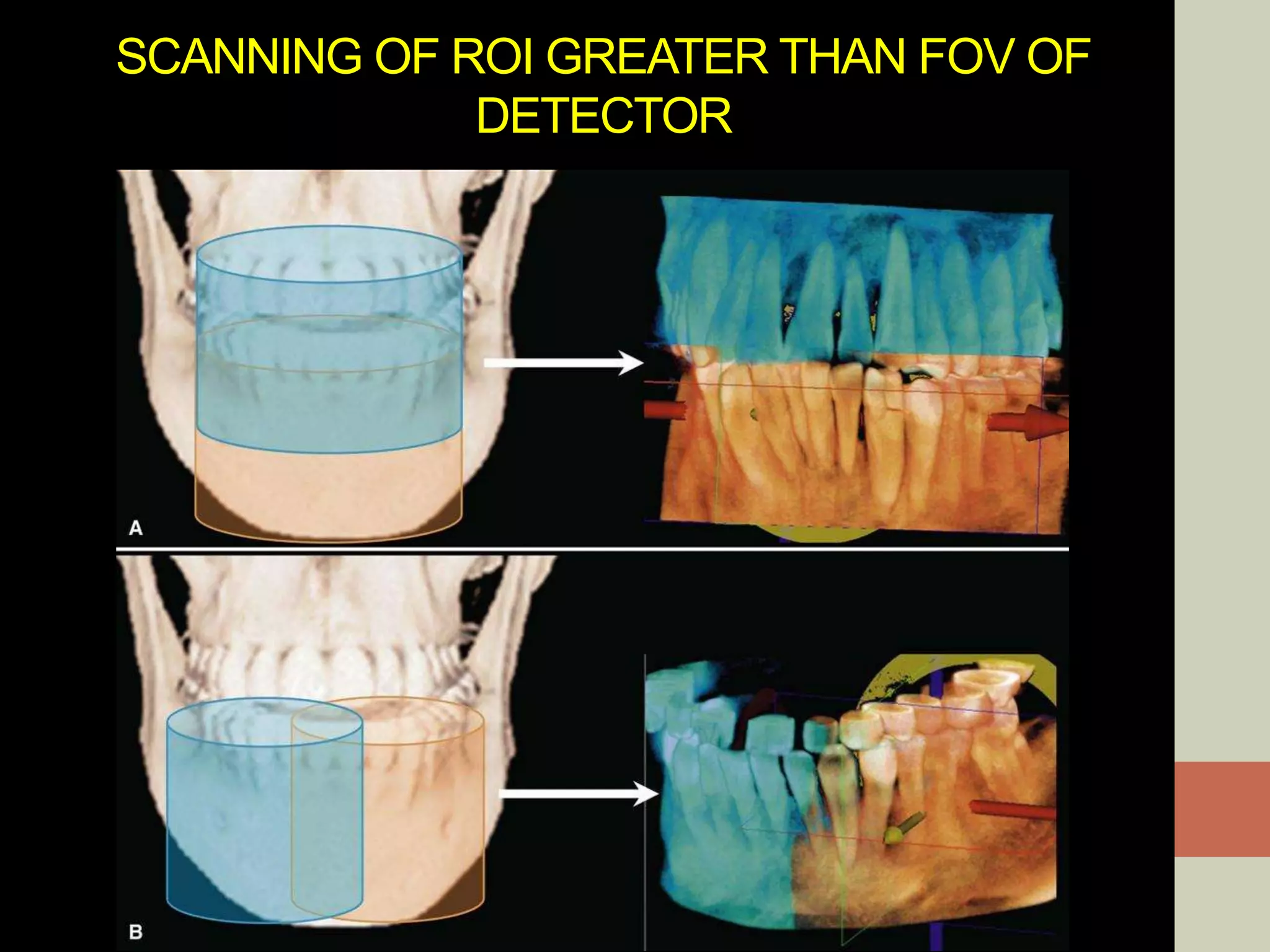 SCANNING OF ROI GREATER THAN FOV OF
DETECTOR
 