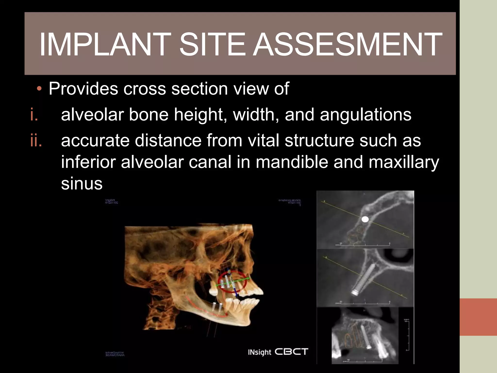 IMPLANT SITE ASSESMENT
• Provides cross section view of
i. alveolar bone height, width, and angulations
ii. accurate distance from vital structure such as
inferior alveolar canal in mandible and maxillary
sinus
 