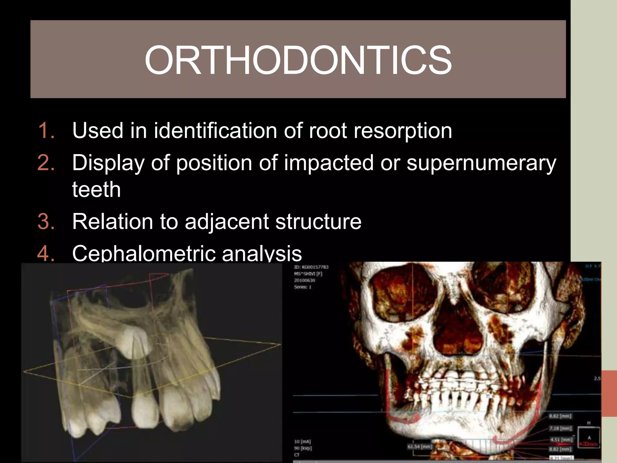 ORTHODONTICS
1. Used in identification of root resorption
2. Display of position of impacted or supernumerary
teeth
3. Relation to adjacent structure
4. Cephalometric analysis
 