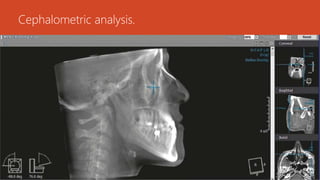 Cone beam computed tomography by dr. maryam salman | PPTX