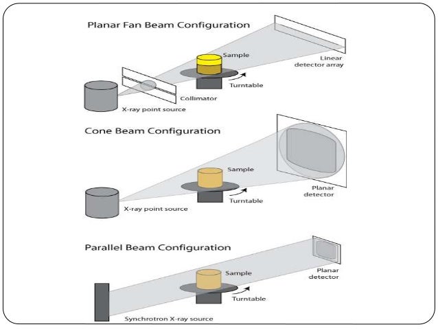 Cone beam computerized tomography mamita