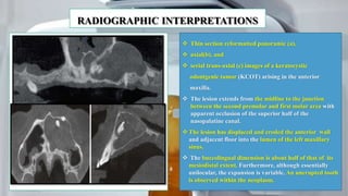 Cone beam ct | PPTX