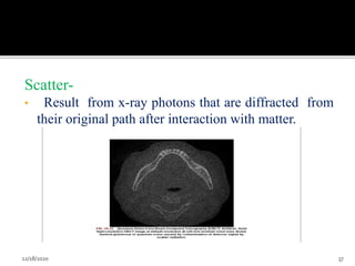 Scatter-
• Result from x-ray photons that are diffracted from
their original path after interaction with matter.
12/18/2020 37
 