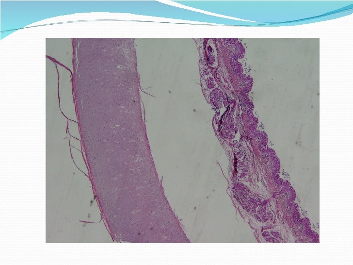 Conective tissue
