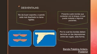 z
DESVENTAJAS:
Banda Palatina Antero-
Posterior
No da buen soporte y cuando
está mal diseñada no tiene
rigidez.
Por lo cual los bordes deben
terminar en las depresiones
entre las rugas, esta forma.
Presenta cuatro bordes que
contactan con la lengua, lo que
puede molestar a algunos
pacientes.
 