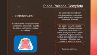 z Placa Palatina Completa
 INDICACIONES :
En situaciones con pocos dientes
remanentes anteriores o cuando
los pilares y el reborde residual
son pobres.
Ausencia de torus.
En clase I con uno a cuatro
premolares y algunos dientes
anteriores remanentes con
pilares en regular estado que no
se pueden mejorar; reborde
residual con reabsorción vertical
excesiva y dificultad para
obtener la retención directa
En clase II de Kennedy con
grandes espacios posteriores
modificados y algunos dientes
anteriores ausentes
 