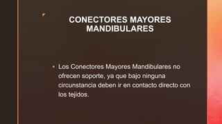 z
CONECTORES MAYORES
MANDIBULARES
 Los Conectores Mayores Mandibulares no
ofrecen soporte, ya que bajo ninguna
circunstancia deben ir en contacto directo con
los tejidos.
 