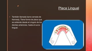 z
Placa Lingual
 También llamada barra cerrada de
Kennedy. Tiene forma de placa que
se extiende desde el cíngulo de los
dientes anteriores, hasta el surco
lingual.
 