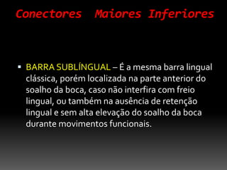 Conectores Maiores Inferiores
 BARRA SUBLÍNGUAL – É a mesma barra lingual
clássica, porém localizada na parte anterior do
soalho da boca, caso não interfira com freio
lingual, ou também na ausência de retenção
lingual e sem alta elevação do soalho da boca
durante movimentos funcionais.
 