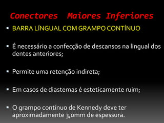 Conectores Maiores Inferiores
 BARRA LÍNGUAL COM GRAMPO CONTÍNUO
 É necessário a confecção de descansos na lingual dos
dentes anteriores;
 Permite uma retenção indireta;
 Em casos de diastemas é esteticamente ruim;
 O grampo contínuo de Kennedy deve ter
aproximadamente 3,0mm de espessura.
 
