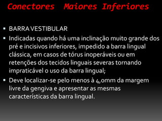 Conectores Maiores Inferiores
 BARRAVESTIBULAR
 Indicadas quando há uma inclinação muito grande dos
pré e incisivos inferiores, impedido a barra lingual
clássica, em casos de tórus inoperáveis ou em
retenções dos tecidos linguais severas tornando
impraticável o uso da barra lingual;
 Deve localizar-se pelo menos à 4,0mm da margem
livre da gengiva e apresentar as mesmas
características da barra lingual.
 