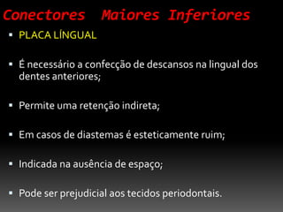 Conectores Maiores Inferiores
 PLACA LÍNGUAL
 É necessário a confecção de descansos na lingual dos
dentes anteriores;
 Permite uma retenção indireta;
 Em casos de diastemas é esteticamente ruim;
 Indicada na ausência de espaço;
 Pode ser prejudicial aos tecidos periodontais.
 