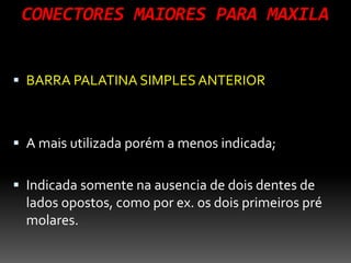 CONECTORES MAIORES PARA MAXILA
 BARRA PALATINA SIMPLES ANTERIOR
 A mais utilizada porém a menos indicada;
 Indicada somente na ausencia de dois dentes de
lados opostos, como por ex. os dois primeiros pré
molares.
 